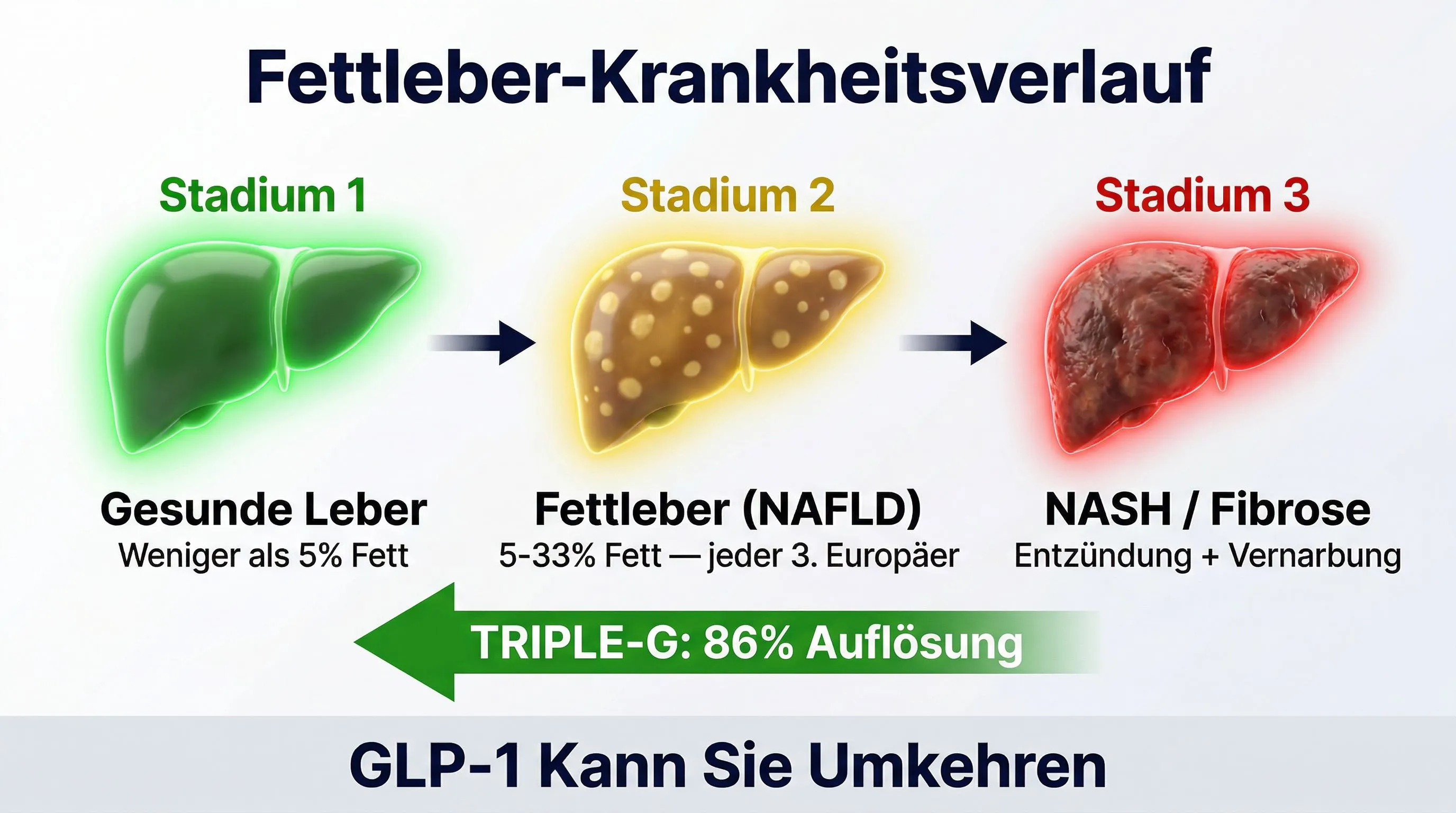 Fettleber Infografik: Verlauf von gesund zu NAFLD zu NASH und Umkehr mit GLP-1